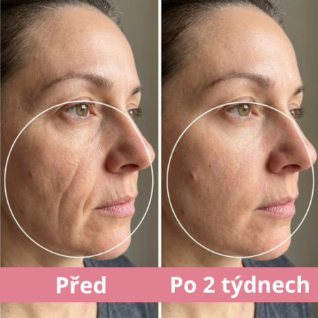 Beauty Sleep: Protivráskový polštář